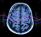 neuropower | praxis für neurofeedback & mentaltraining für sportler und manager